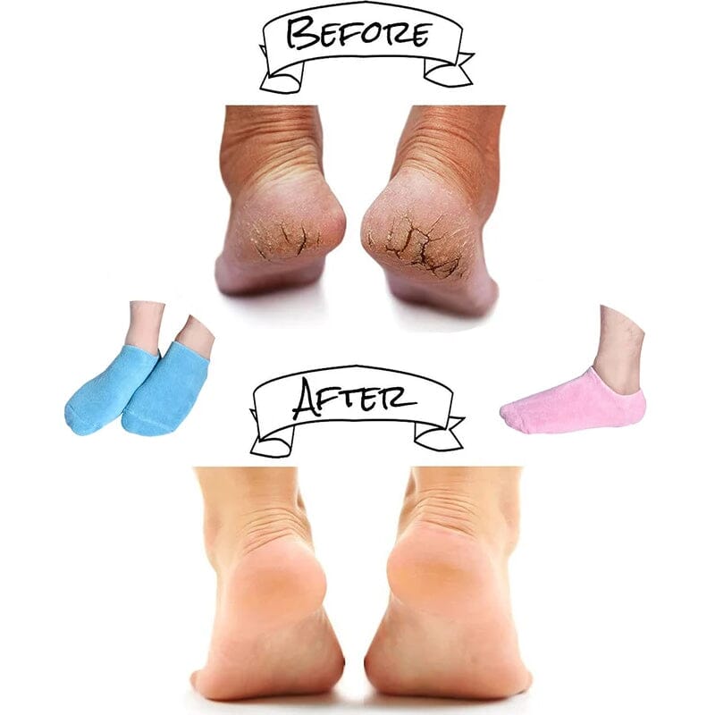 Moisturizing Socks with Gel Lining